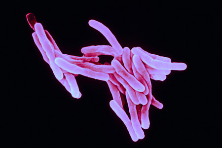  Imagem de <EM>Mycobacterium tuberculosis</EM> 