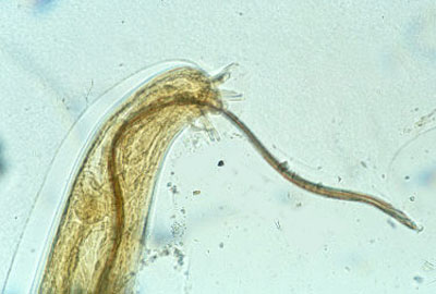 Parte da cauda de um <EM>A. cantonensis</EM> (Foto: Web Atlas de Parasitologia Médica) 