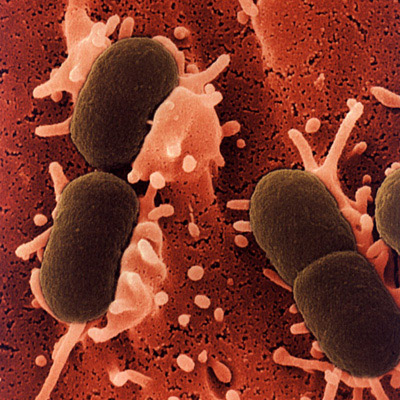  Imagem de <EM>Escherichia coli</EM>, um dos principais patógenos das infecções de sítio cirúrgico de ambos os grupos, tanto no ambiente hospitalar quanto no extra-hospitalar (Foto: Kimicontrol) 