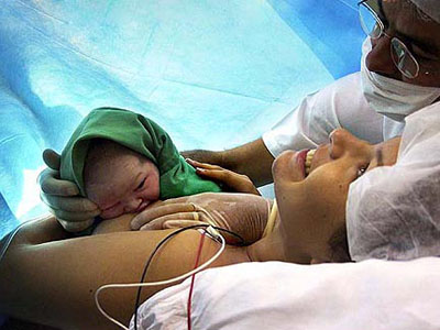  A cesárea, quando feita de forma não criteriosa, oferece maior risco para a mãe e o bebê (Foto: Ana Limp) 