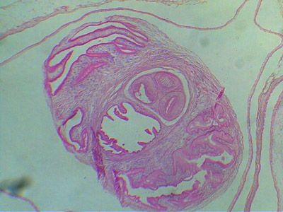  Imagem do parasita <EM>Taenia solium</EM> (Foto: Universidade da Califórnia) 