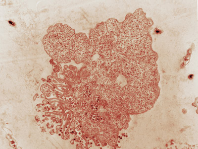  Imagem por por microscopia eletrônica do vírus HIV (Foto: Monika Barth) 