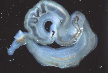  Imagem de um verme adulto do gênero Schistosoma (Foto: Sinclair Stammers/TDR/OMS) 