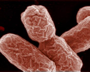Pesquisadora comenta a epidemia de E. coli na Europa