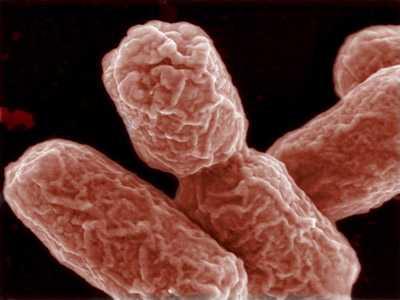  Imagem de <EM>Escherichia coli</EM> 