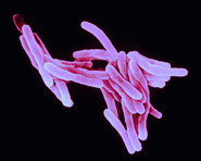 Fiocruz investe no diagnóstico da tuberculose multirresistente