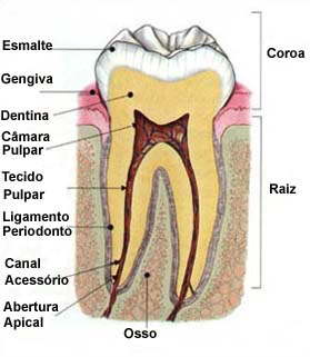  A periondontite causa a reabsorção do osso que está ao redor das raízes 