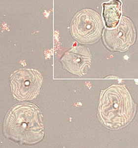  Na imagem obtida por microscopia confocal é possível ver as espículas em cortes radiais (Foto: IOC) 