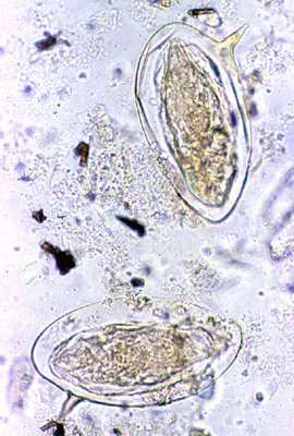  Ovos de <EM>Schistosoma mansoni</EM> 