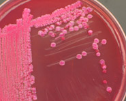 Kit identifica as principais infecções por E.coli na Região Norte