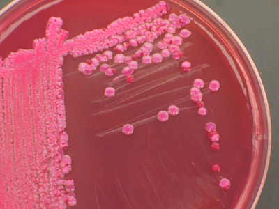  A transmissão da <EM>E. coli</EM> ocorre pela ingestão de alimentos e água contaminados com fezes 