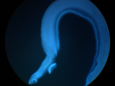  Imagem de um verme adulto macho, cultivado <EM>in vitro</EM>, marcado com a sonda Hoechst 33258 e visualizado por microscopia de fluorecência (Foto: Laboratório de Esquistossomose da Fiocruz Minas) 