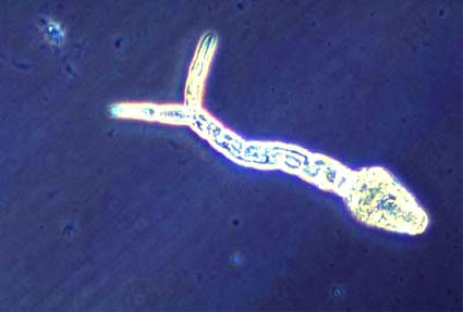  O <EM>Schistosoma mansoni</EM> em forma de cercária (Foto: Sinclair Stammers/TDR/OMS) 