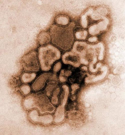  O vírus H1N1 
