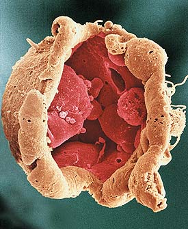  Embrião humano na fase de blastocisto, do qual se extraem as células-tronco embrionárias 