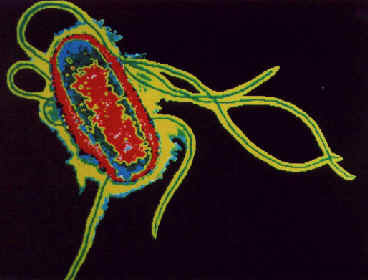 A bactéria <EM>E. coli</EM> ampliada 30 mil vezes (Foto: Academia de Ciência e Tecnologia) 