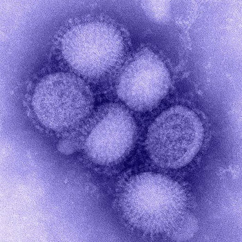  Imagem do vírus H1N1 