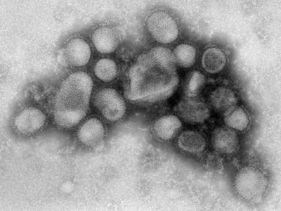  Imagem do vírus influenza A (H1N1) 