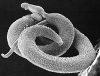  Imagem de <EM>Schistosoma mansoni (</EM>Foto: Instituto de Medicina Molecular da Universidade de Dublin) 