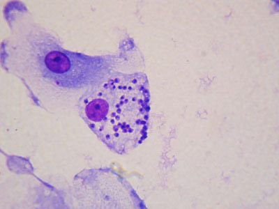  A imagem exibe célula do sistema imunológico infectada por parasitos do genêro Leishmania (pontos menores), causadores da doença transmitida ao homem por insetos (Foto: Victor Barreto/IOC) 