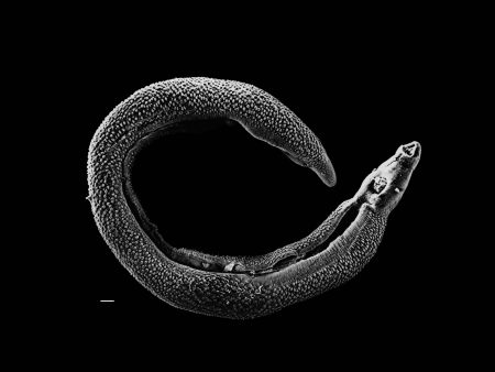  Imagem do parasita<EM> Schistosoma</EM>, que causa a esquistossomose 