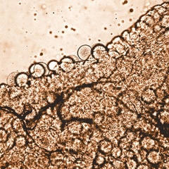  Imagem na capa da nova edição da revista mostra oocistos de <EM>Plasmodium vivax</EM> no intestino médio de um <EM>Anopheles cracens</EM> 