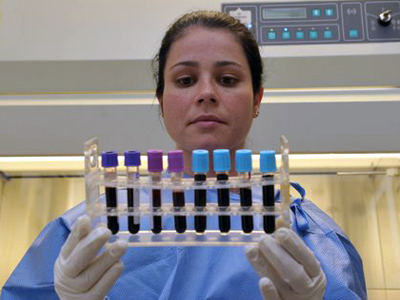  O estudo de Raquel Teixeira identificou alterações genéticas associadas ao risco da ocorrência de hepatite medicamentosa em pacientes submetidos a esquemas terapêuticos à base de isoniazida<BR><br />
(Foto: Gutemberg Brito) 