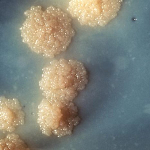  Colônias de <EM>Mycobacterium tuberculosis</EM> (Foto: Wikipedia) 