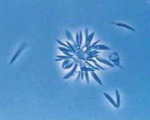  Formas promastigotas de <EM>Leishmania sp</EM> desenvolvidas em meio de cultura. Estas formas estão presentes, também, no intestino do vetor (Foto: Sucen) 