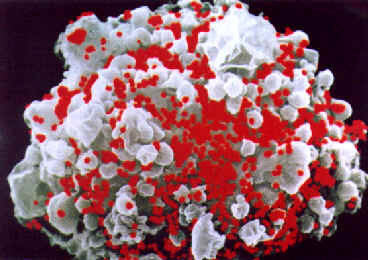  O vírus HIV (em vermelho) ataca preferencialmente o leucócito (branco) denominado por linfócito T auxiliar. O vírus penetra a célula e a destrói. A imagem foi aumentada 20 mil vezes 