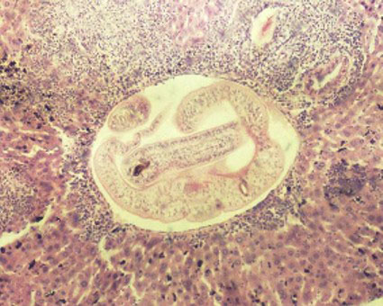  O <EM>Schistossoma mansoni</EM> dentro de um vaso no fígado (Foto: UFRGS) 