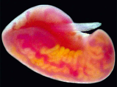  Imagem de <EM>Didymosulcus palati</EM>, parasita de três espécies de atum cuja foto está na capa da revista 