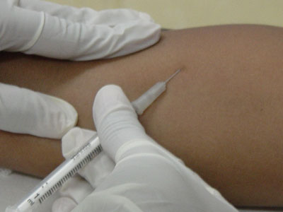  Antígeno de Montenegro é aplicado na pele para o diagnóstico de leishmaniose (Foto: Ipec) 