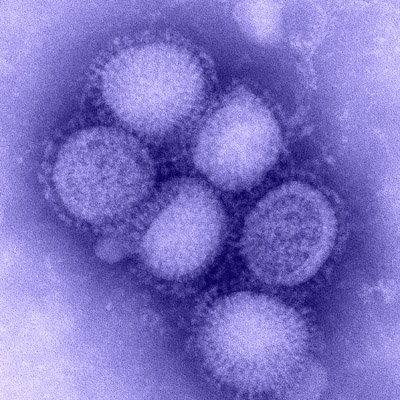  Imagem do vírus infuenza H1N1 (Foto: CDC) 