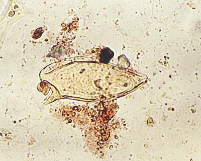  Ovos de Schistossoma mansoni, helminto causador da esquistossomose (Foto: UFRGS) 