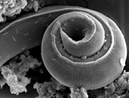 Perfil de parasitas de 'Angiostrongylus costaricensis' é caracterizado