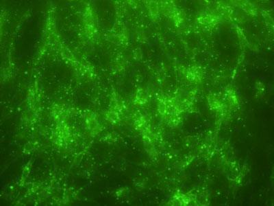  Técnica rápida de inibição de focos fluorescentes. As células infectadas pelo vírus da raiva são reveladas pelo conjugado (Foto: Wildeberg Moreira) 