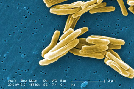 Imagens de <EM>Mycobacterium tuberculosis</EM> 