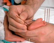 Estudo avalia desempenho de programa de triagem neonatal