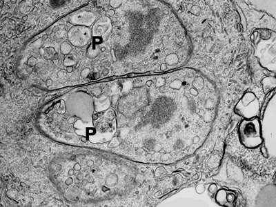  Reprodução sexuada do <EM>T. gondii</EM> no intestino: esta etapa do ciclo de vida do parasito acontece somente no intestino dos felinos, seus reservatórios naturais 