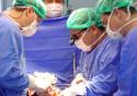 Trabalho aponta disparidades nas filas de transplantes de órgãos