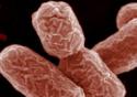 Pesquisadora comenta a epidemia de E. coli na Europa
