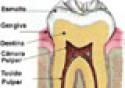 Pesquisa busca aprimorar diagnóstico de doença periodontal