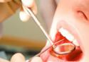 Pesquisa avalia a necessidade de tratamento odontológico em PE