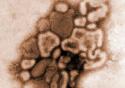 Canal Saúde faz balanço da gripe A H1N1