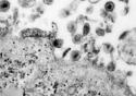 Linhagem africana do vírus HTLV-1 é identificada no Brasil